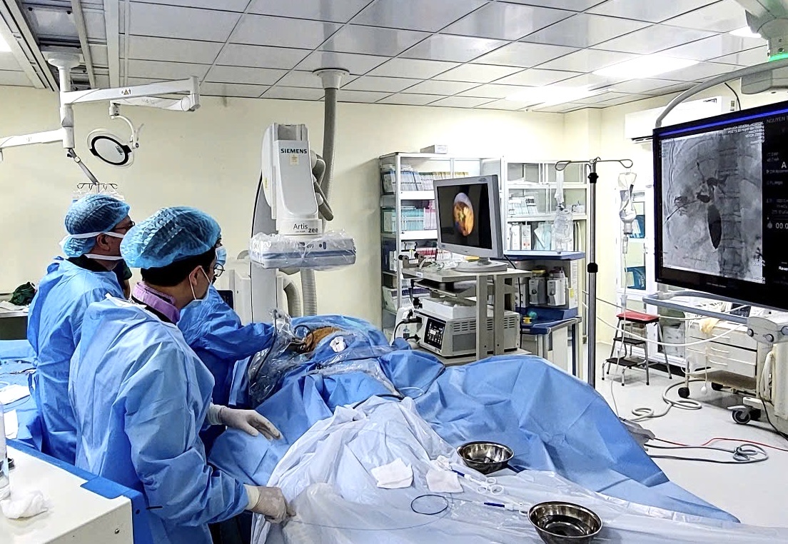 Tán sỏi đường mật qua da dưới hướng dẫn DSA: Mở thêm cơ hội cho bệnh nhân