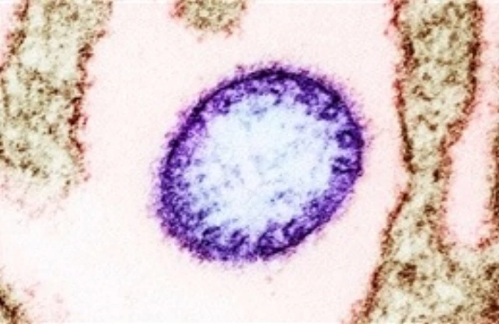 Các cơ sở y tế chủ động phòng, chống bệnh do virus Nipah