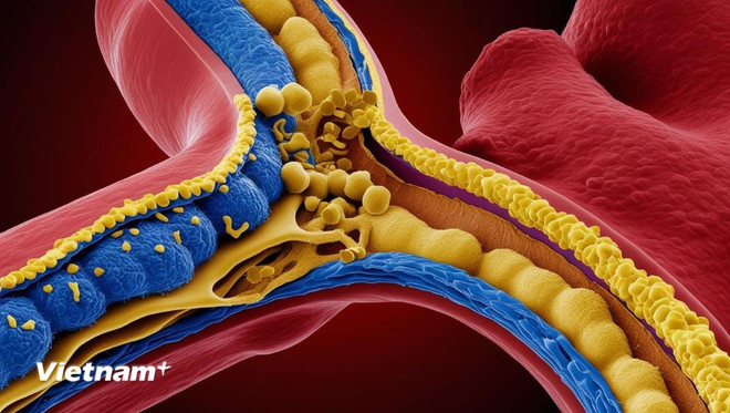 Vì sao không thừa cân nhưng người gầy vẫn bị mỡ máu cao?