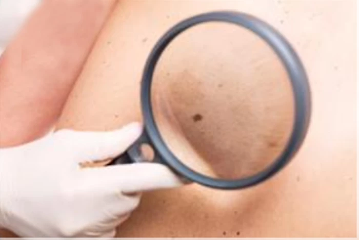 AI tạo protein trị ung thư, biết 'định vị như Google Maps' tới khối u