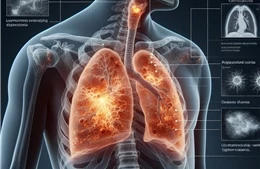 Ô nhiễm không khí làm gia tăng đột biến ung thư phổi ở người không hút thuốc lá