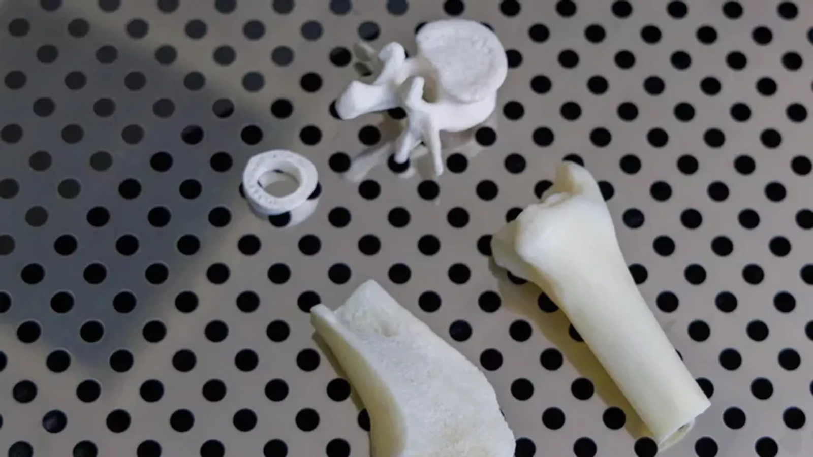 Các nhà khoa học Nga tạo ra vật liệu ghép xương từ chất thải