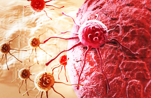 Nghiên cứu mới đã tìm ra cách để ngăn chặn các tế bào ung thư di căn sang các mô khỏe mạnh khác
