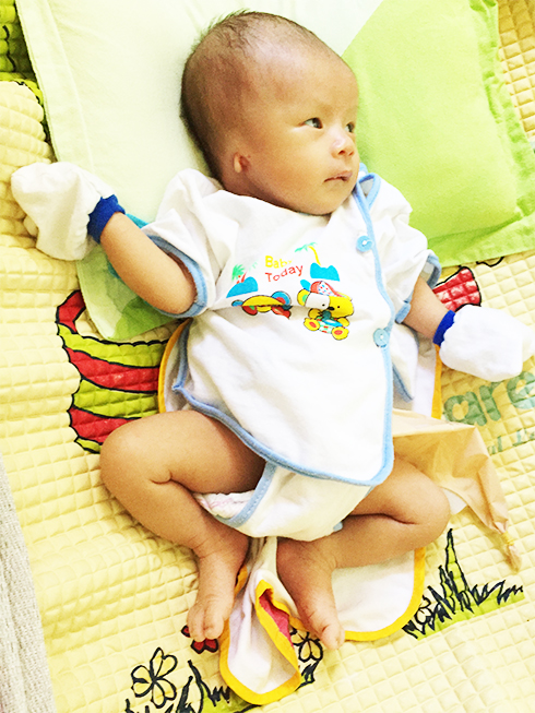 Mới hơn 1 tháng tuổi, bé Lê Hồng Vũ  đã mang trong mình nhiều bệnh hiểm nghèo.