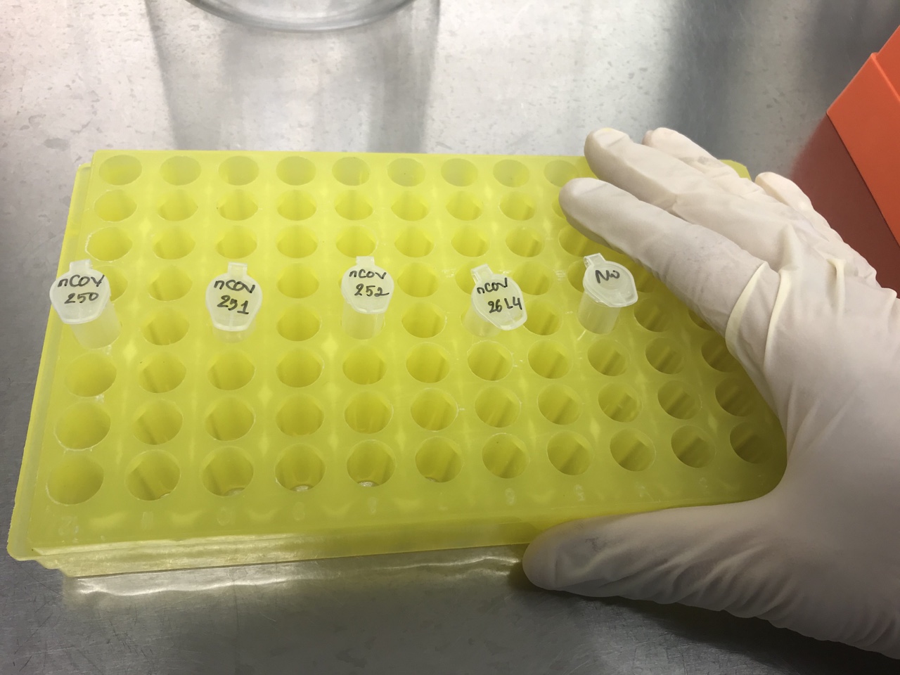 Mẫu bệnh phẩm nghi nhiễm Covid-19 đang được xét nghiệm tại Viện Pasteur Nha Trang