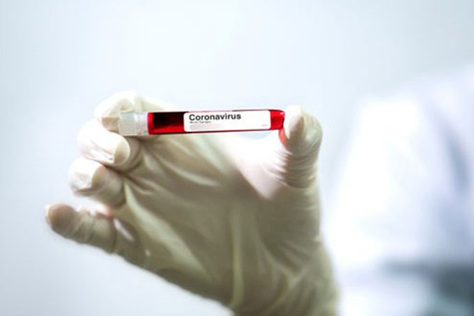 Tổng số ca nhiễm virus corona chủng mới SARS-CoV-2 (gây dịch bệnh Covid-19) trên toàn thế giới là 720.217 trường hợp. Ảnh: Scientific American