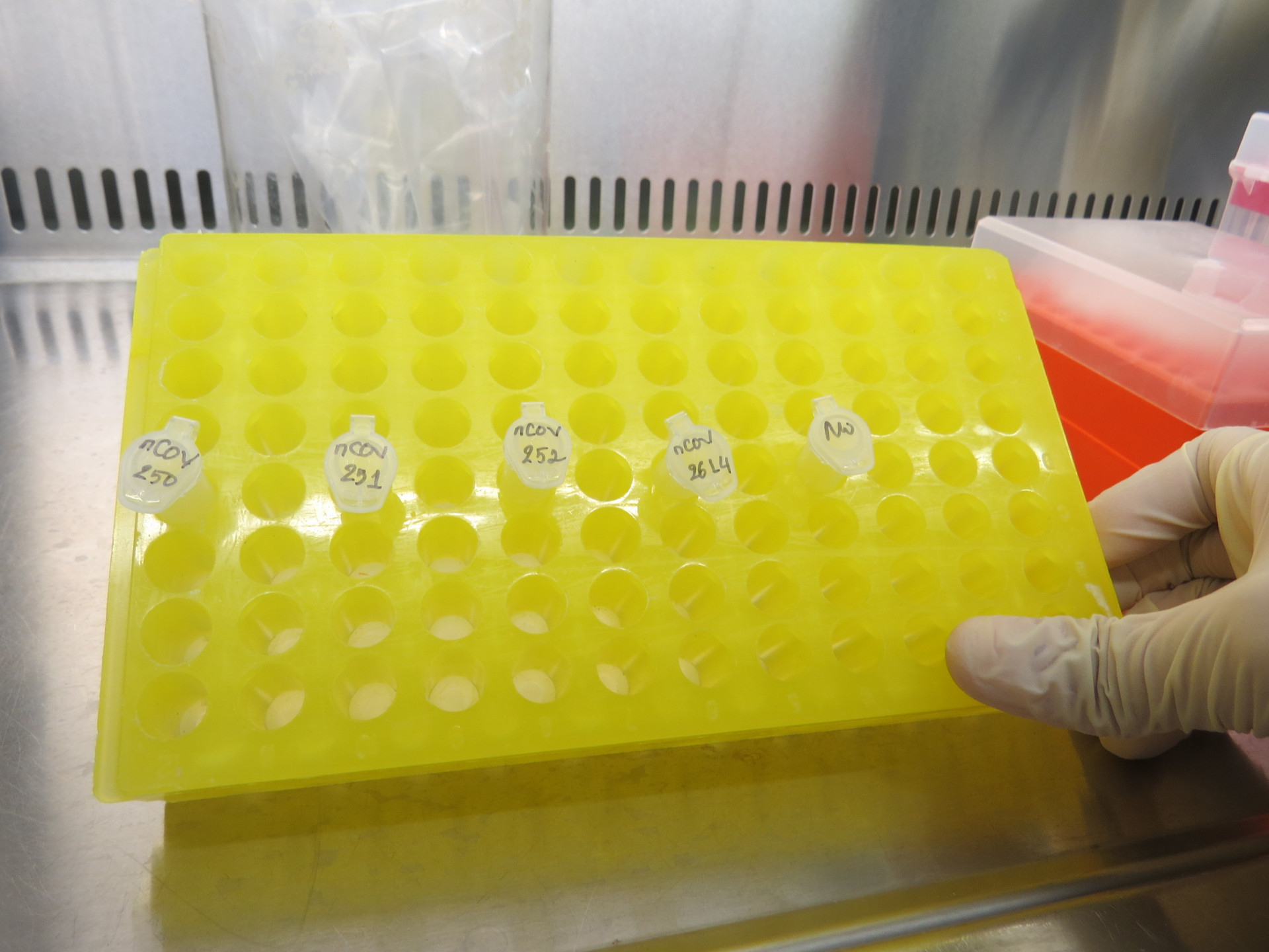 Các mẫu xét nghiệm Covid-19 tại Viện Pasteur Nha Trang
