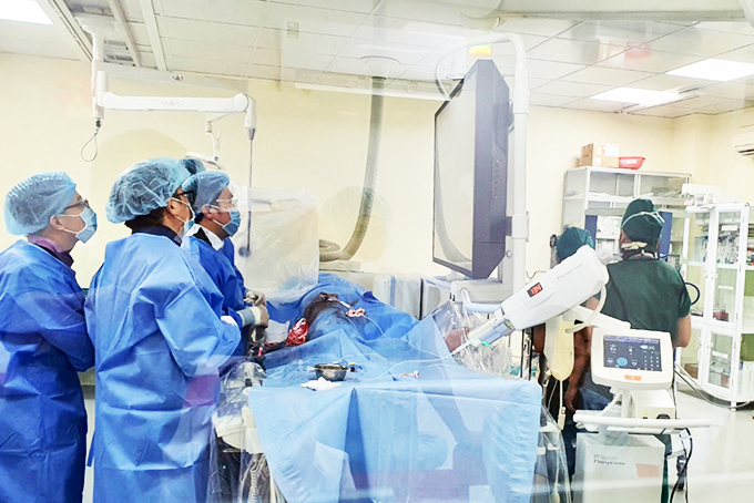 Can thiệp nội mạch thần kinh: Giải pháp tối ưu điều trị tắc mạch máu não