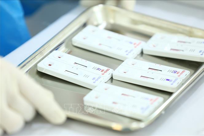 Chủ động mua sắm thiết bị xét nghiệm, vật tư y tế