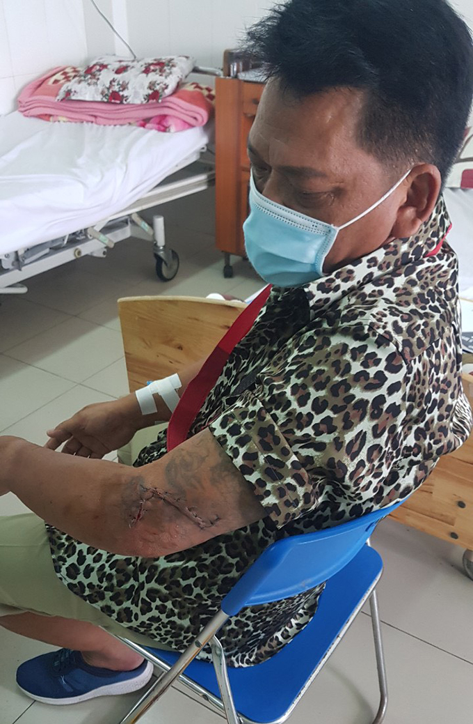 Khởi tố kẻ chém người sau cự cãi