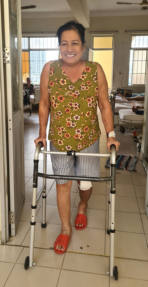 Thay khớp háng, gối 4 lần cho bệnh nhân