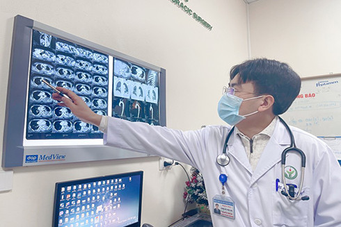 PGS, TS Phùng Duy Hồng Sơn cho biết lóc động mạch chủ cấp tính dẫn tới tử vong rất nhanh.